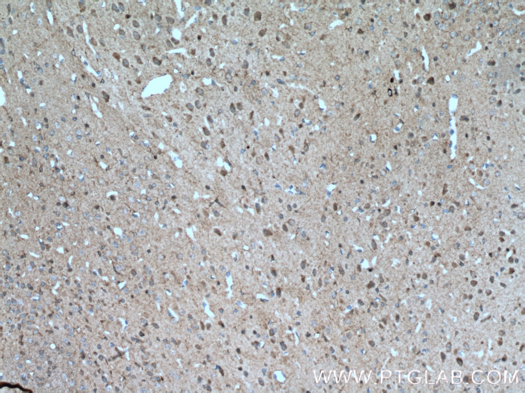 Immunohistochemistry (IHC) staining of mouse brain tissue using ENPP6 Polyclonal antibody (12643-1-AP)