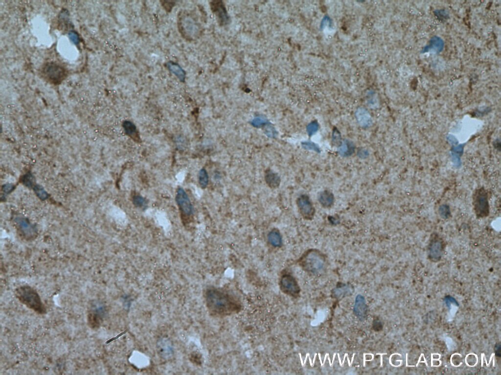 Immunohistochemistry (IHC) staining of mouse brain tissue using ENPP6 Polyclonal antibody (12643-1-AP)