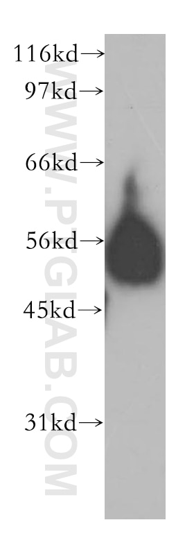 Western Blot (WB) analysis of human brain tissue using ENPP6 Polyclonal antibody (12643-1-AP)