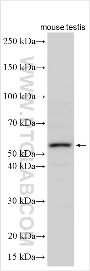 Western Blot (WB) analysis of various lysates using ENPP7 Polyclonal antibody (32226-1-AP)