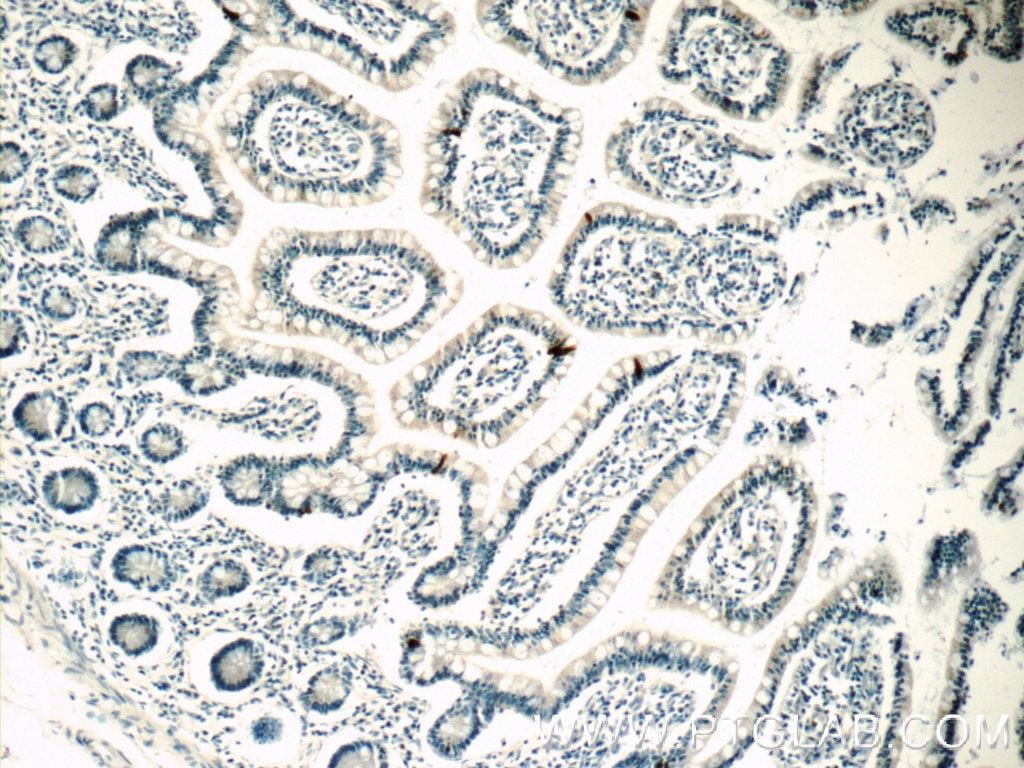 IHC staining of human small intestine using 14518-1-AP