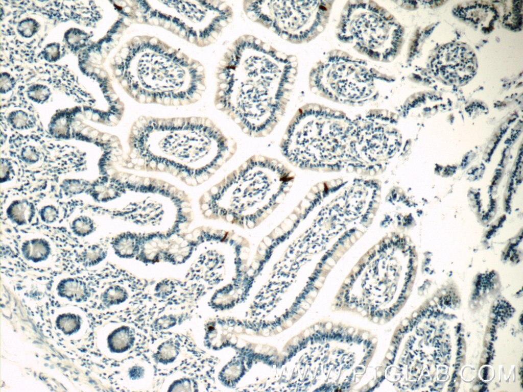 Immunohistochemistry (IHC) staining of human small intestine tissue using ENSA Polyclonal antibody (14518-1-AP)