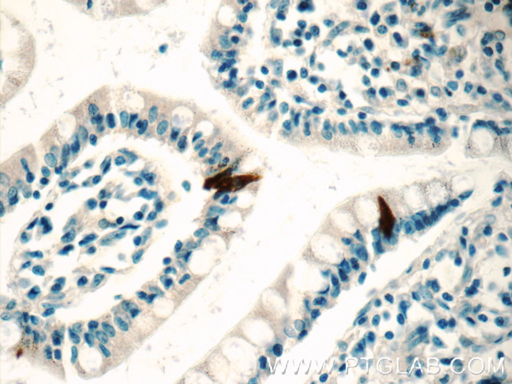 IHC staining of human small intestine using 14518-1-AP