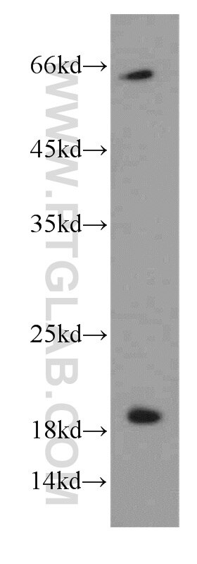 Western Blot (WB) analysis of HeLa cells using ENSA Polyclonal antibody (14518-1-AP)