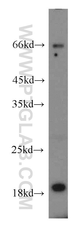 Western Blot (WB) analysis of mouse brain tissue using ENSA Polyclonal antibody (14518-1-AP)