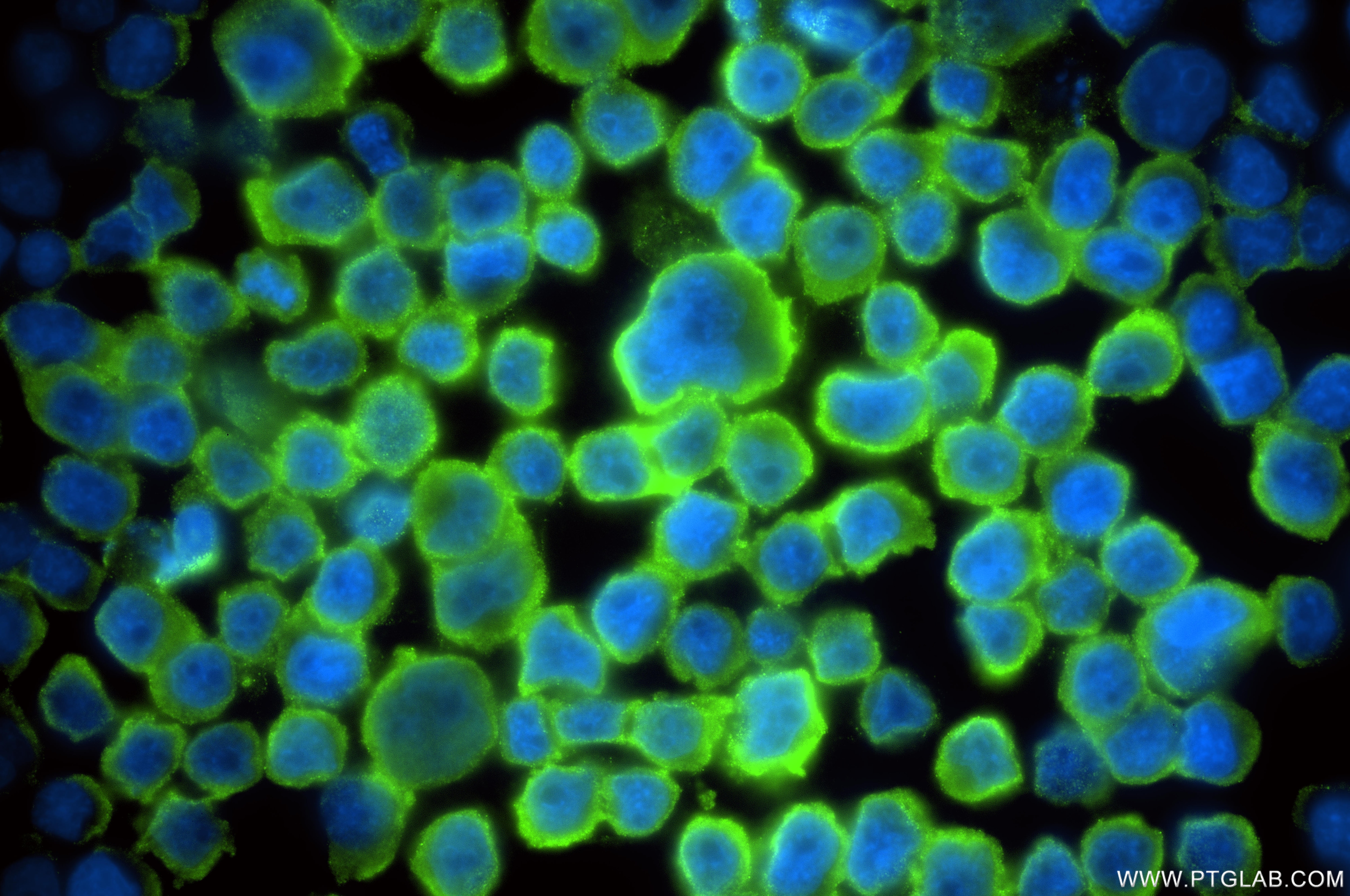 IF Staining of COLO 320 using 86820-1-RR (same clone as 86820-1-PBS) Immunofluorescence (IF) / fluorescent staining of COLO 320 cells using ENSA Recombinant monoclonal antibody (86820-1-RR)