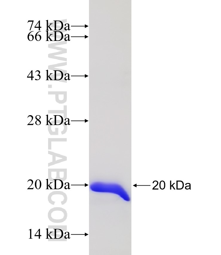 ENSA fusion protein Ag14484 SDS-PAGE