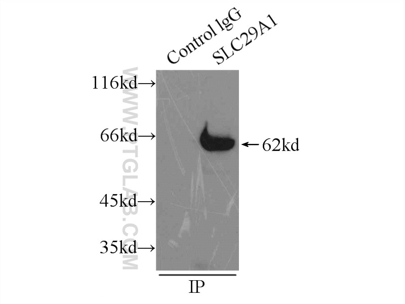 Immunoprecipitation (IP) experiment of mouse brain tissue using ENT1 Polyclonal antibody (11337-1-AP)