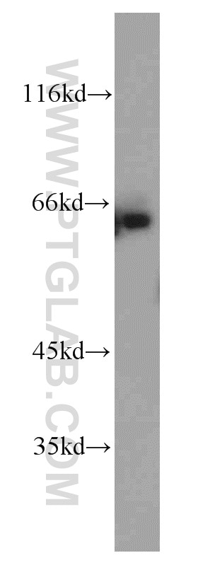 Western Blot (WB) analysis of mouse liver tissue using ENT1 Polyclonal antibody (11337-1-AP)