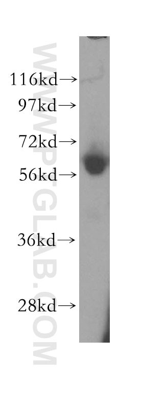 Western Blot (WB) analysis of human liver tissue using ENT1 Polyclonal antibody (11337-1-AP)