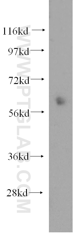 Western Blot (WB) analysis of mouse lung tissue using ENT1 Polyclonal antibody (11337-1-AP)