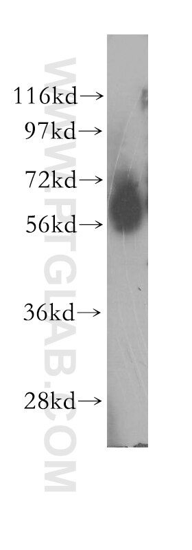 Western Blot (WB) analysis of human spleen tissue using ENT1 Polyclonal antibody (11337-1-AP)