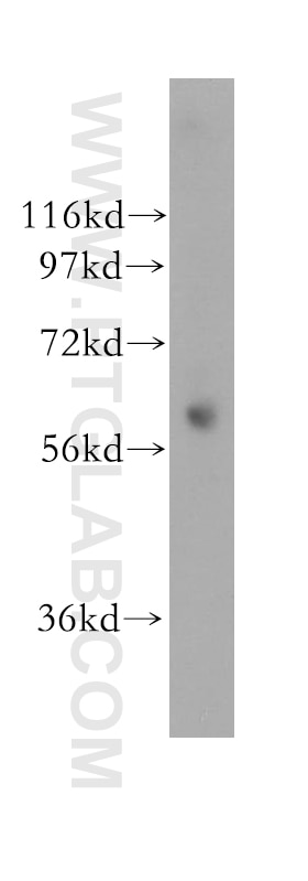 Western Blot (WB) analysis of human lung tissue using ENT1 Polyclonal antibody (11337-1-AP)