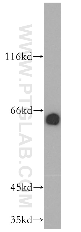 Western Blot (WB) analysis of mouse brain tissue using ENT1 Polyclonal antibody (11337-1-AP)