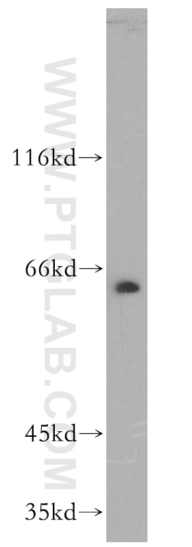 Western Blot (WB) analysis of mouse testis tissue using ENT1 Polyclonal antibody (11337-1-AP)