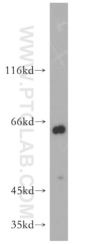 Western Blot (WB) analysis of mouse kidney tissue using ENT1 Polyclonal antibody (11337-1-AP)