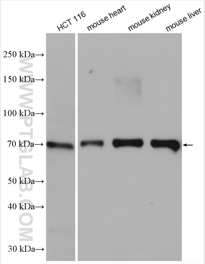 Western Blot (WB) analysis of various lysates using ENT1 Polyclonal antibody (29862-1-AP)