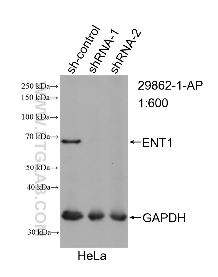 Western Blot (WB) analysis of HeLa cells using ENT1 Polyclonal antibody (29862-1-AP)