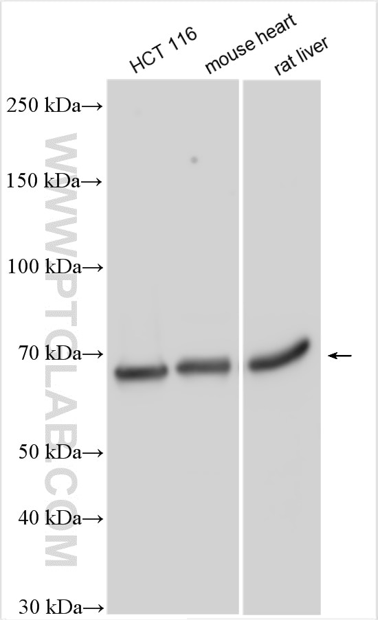 Western Blot (WB) analysis of various lysates using ENT1 Polyclonal antibody (29862-1-AP)
