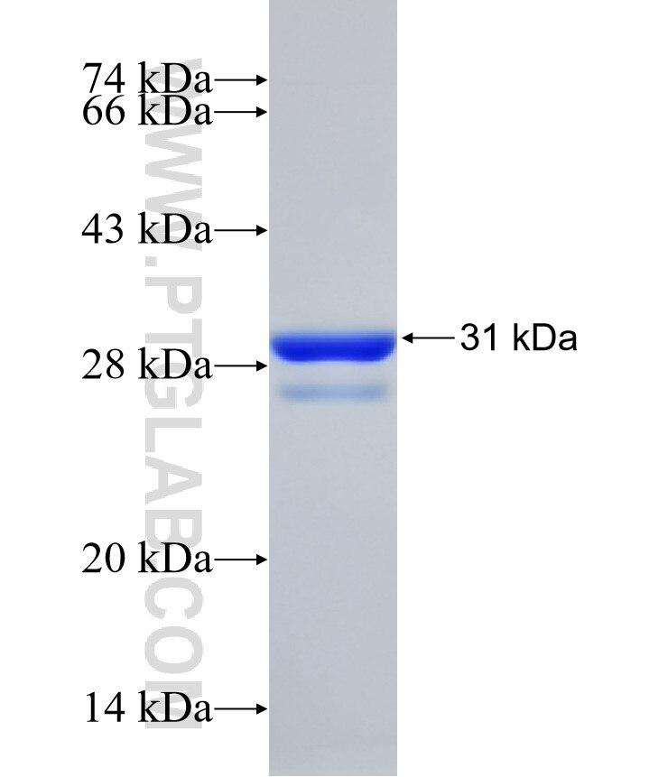 ENT1 fusion protein Ag32004 SDS-PAGE ENT1 fusion protein Ag32004 SDS-PAGE