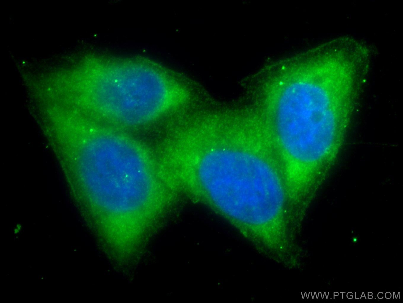 Immunofluorescence (IF) / fluorescent staining of HeLa cells using CD39/ENTPD1 Polyclonal antibody (14211-1-AP)
