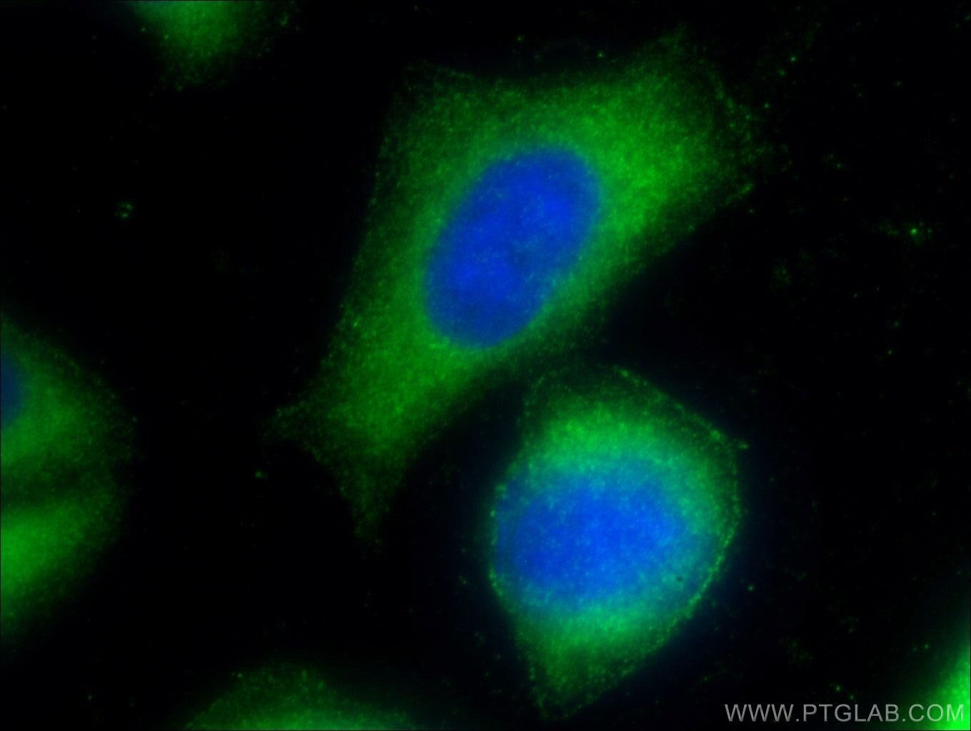 Immunofluorescence (IF) / fluorescent staining of HeLa cells using CD39/ENTPD1 Polyclonal antibody (14211-1-AP)