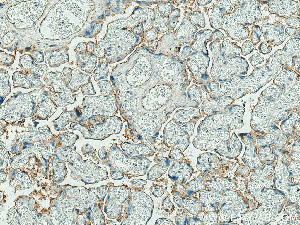 IHC staining of human placenta using 14211-1-AP