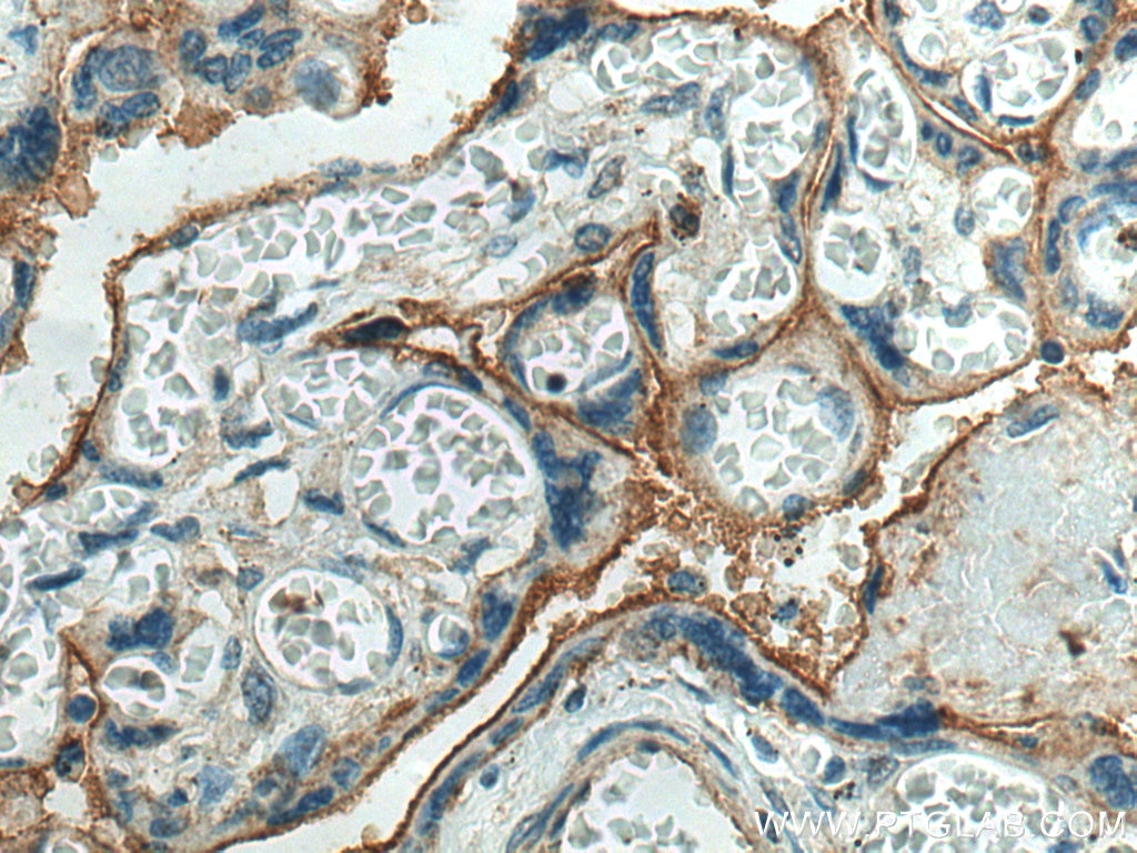 Immunohistochemistry (IHC) staining of human placenta tissue using CD39/ENTPD1 Polyclonal antibody (14211-1-AP)