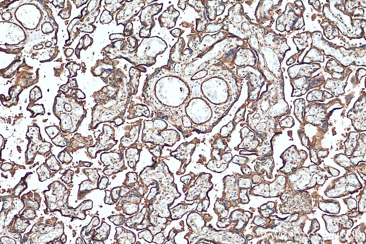 Immunohistochemistry (IHC) staining of human placenta tissue using CD39/ENTPD1 Polyclonal antibody (14211-1-AP)