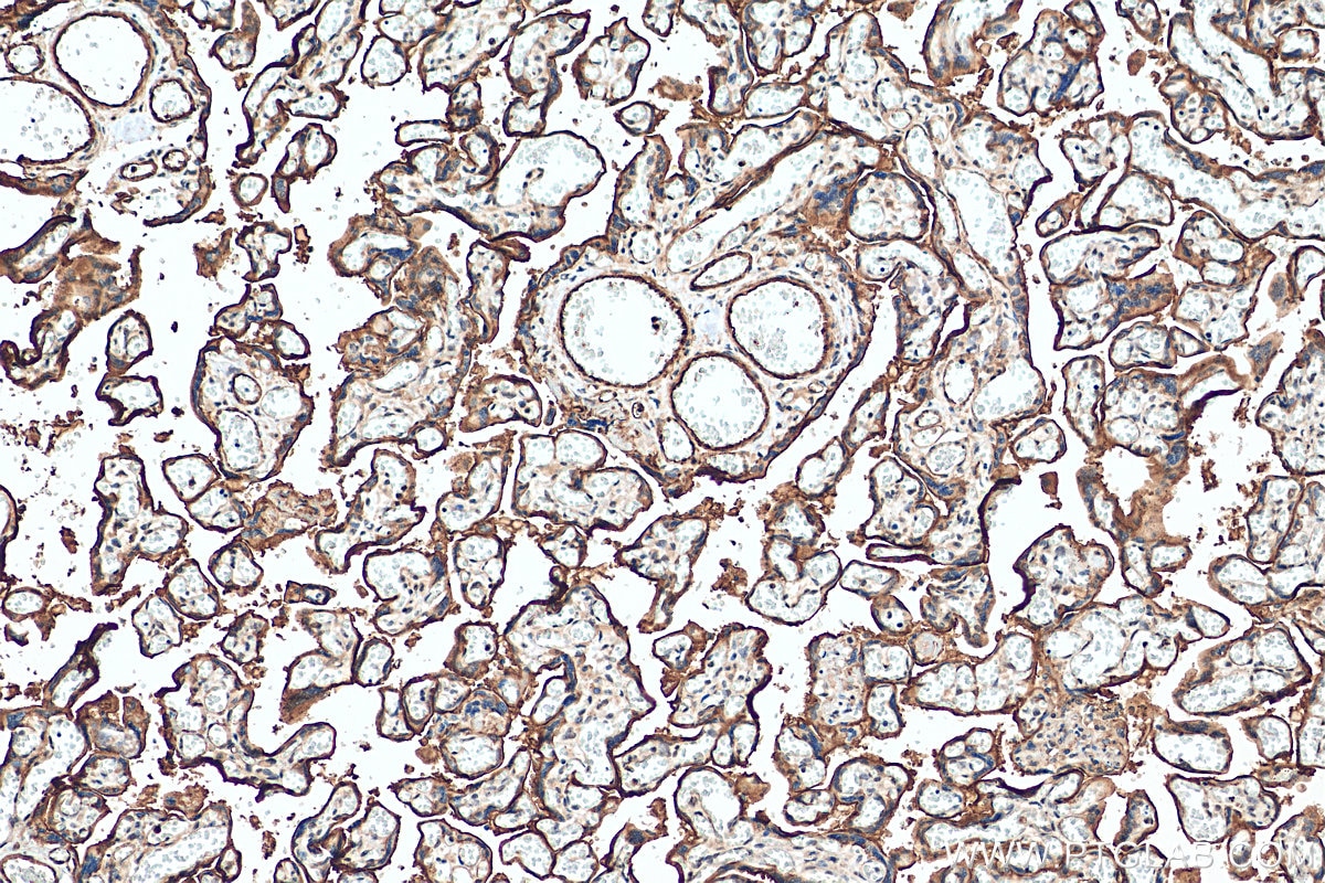 IHC staining of human placenta using 14211-1-AP