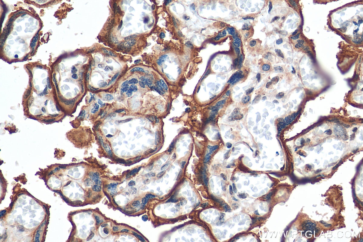 Immunohistochemistry (IHC) staining of human placenta tissue using CD39/ENTPD1 Polyclonal antibody (14211-1-AP)