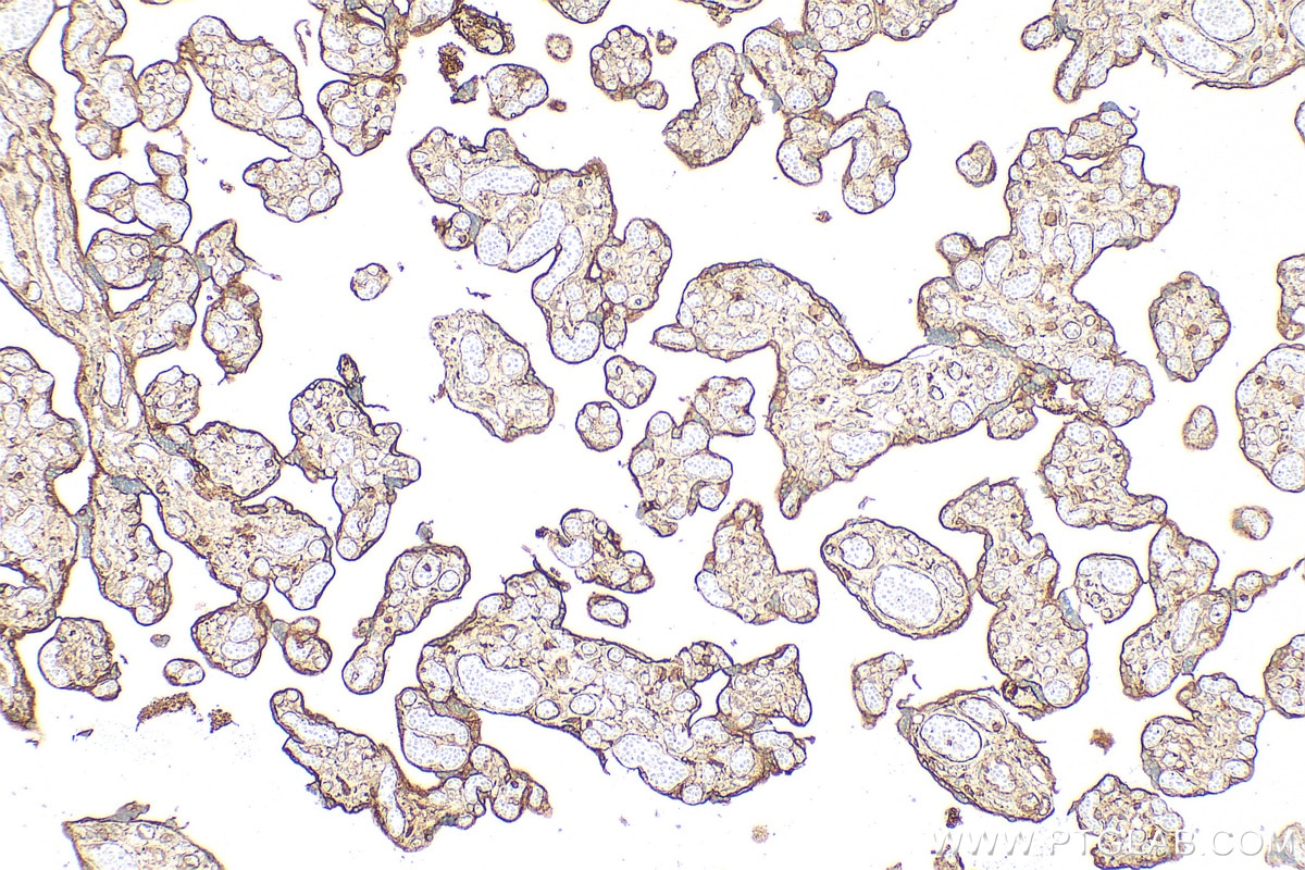IHC staining of human placenta using 14211-1-AP Immunohistochemistry (IHC) staining of human placenta tissue using CD39/ENTPD1 Polyclonal antibody (14211-1-AP)