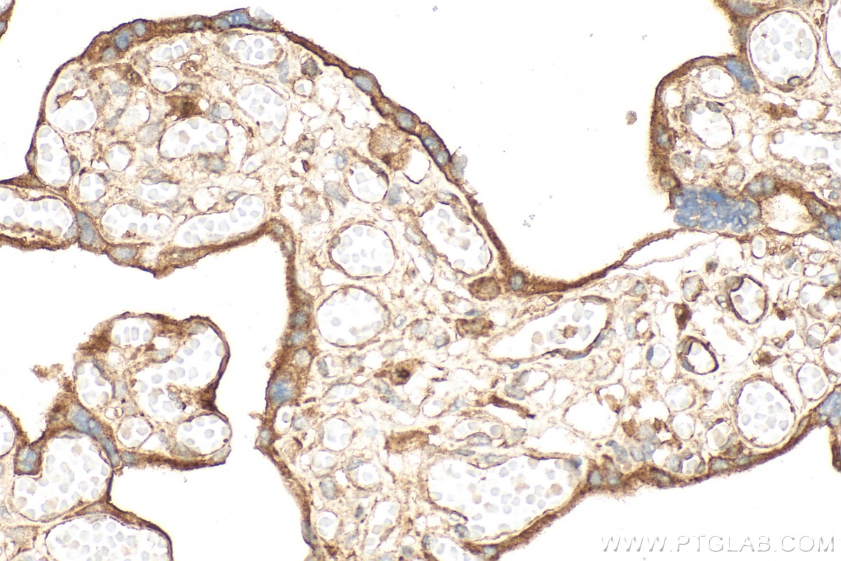 IHC staining of human placenta using 14211-1-AP Immunohistochemistry (IHC) staining of human placenta tissue using CD39/ENTPD1 Polyclonal antibody (14211-1-AP)