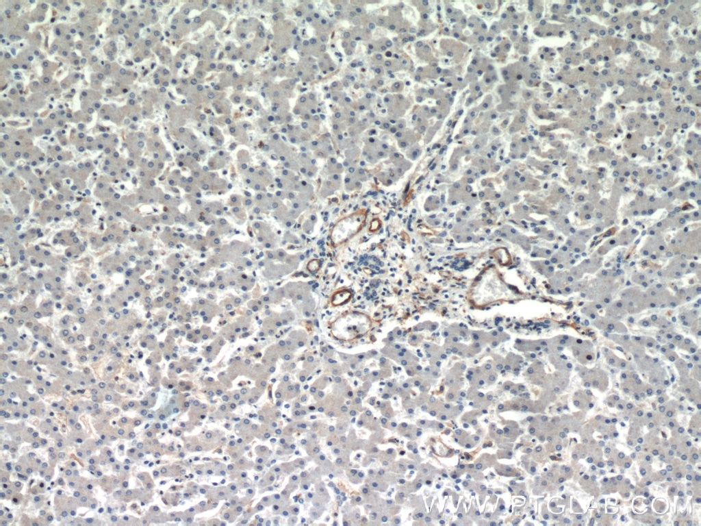 IHC staining of human liver using 14211-1-AP