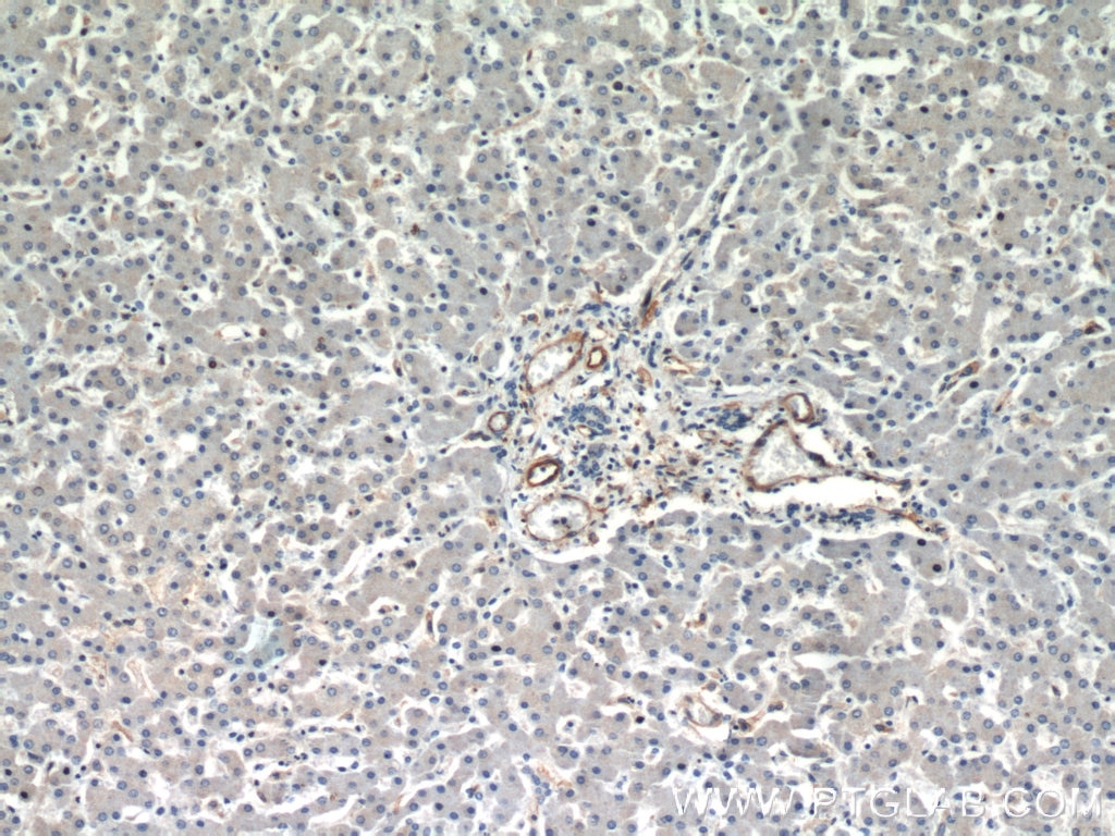 Immunohistochemistry (IHC) staining of human liver tissue using CD39/ENTPD1 Polyclonal antibody (14211-1-AP)