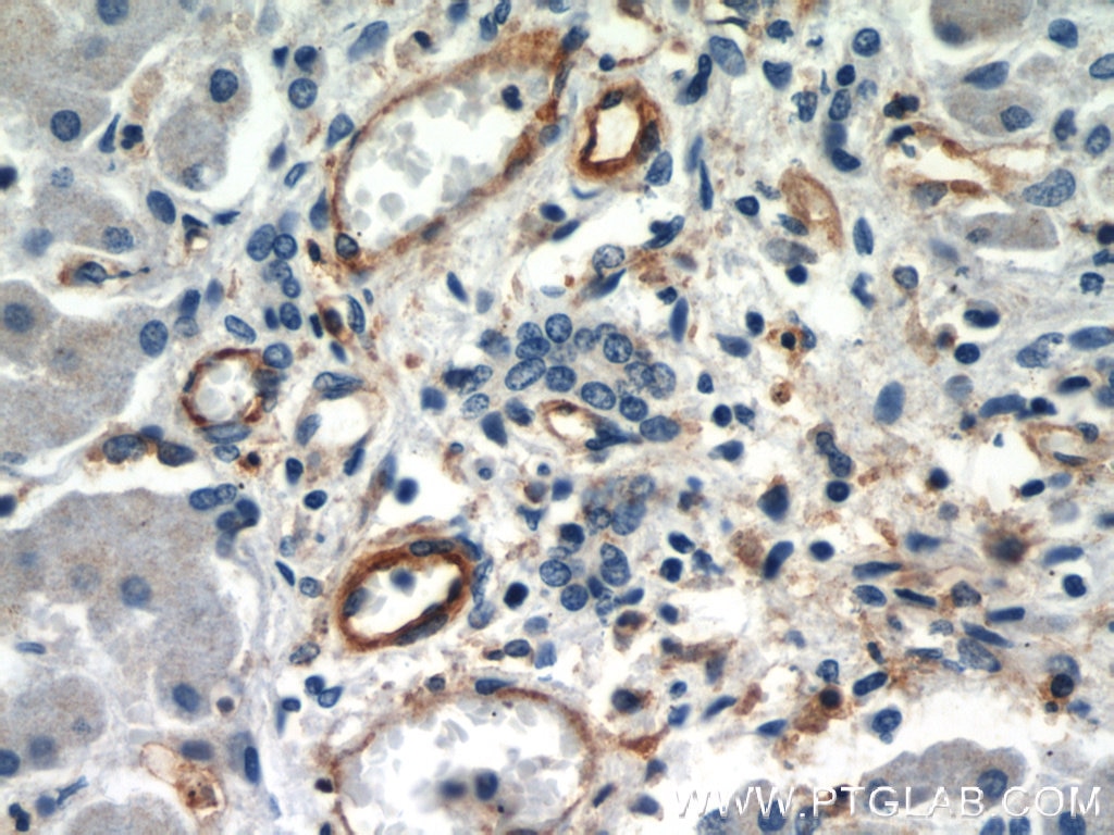 Immunohistochemistry (IHC) staining of human liver tissue using CD39/ENTPD1 Polyclonal antibody (14211-1-AP)