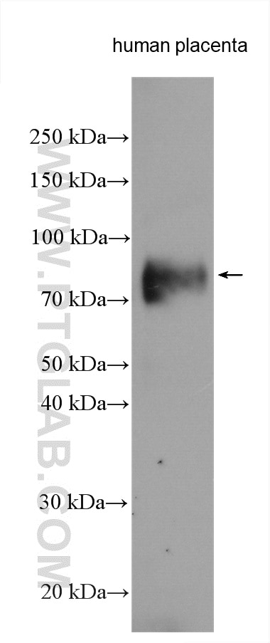 Western Blot (WB) analysis of various lysates using CD39/ENTPD1 Polyclonal antibody (14211-1-AP)