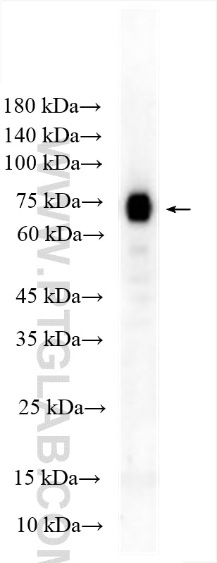 Western Blot (WB) analysis of human placenta tissue using CD39/ENTPD1 Polyclonal antibody (14211-1-AP)