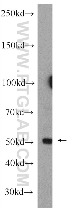 Western Blot (WB) analysis of mouse placenta tissue using CD39/ENTPD1 Polyclonal antibody (14211-1-AP)