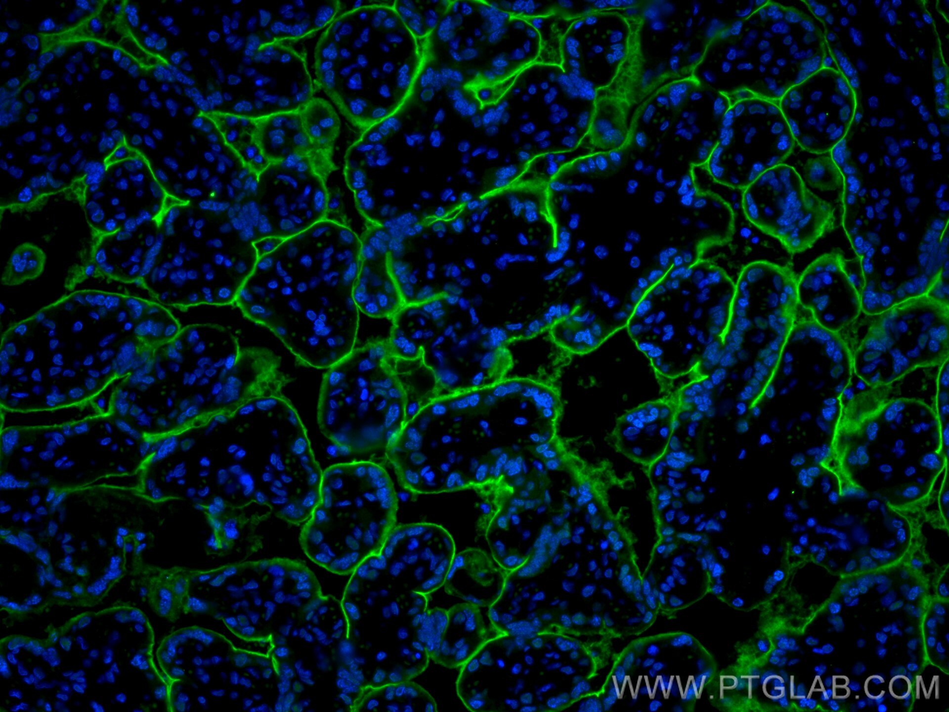 Immunofluorescence (IF) / fluorescent staining of human placenta tissue using CD39/ENTPD1 Polyclonal antibody (19229-1-AP)