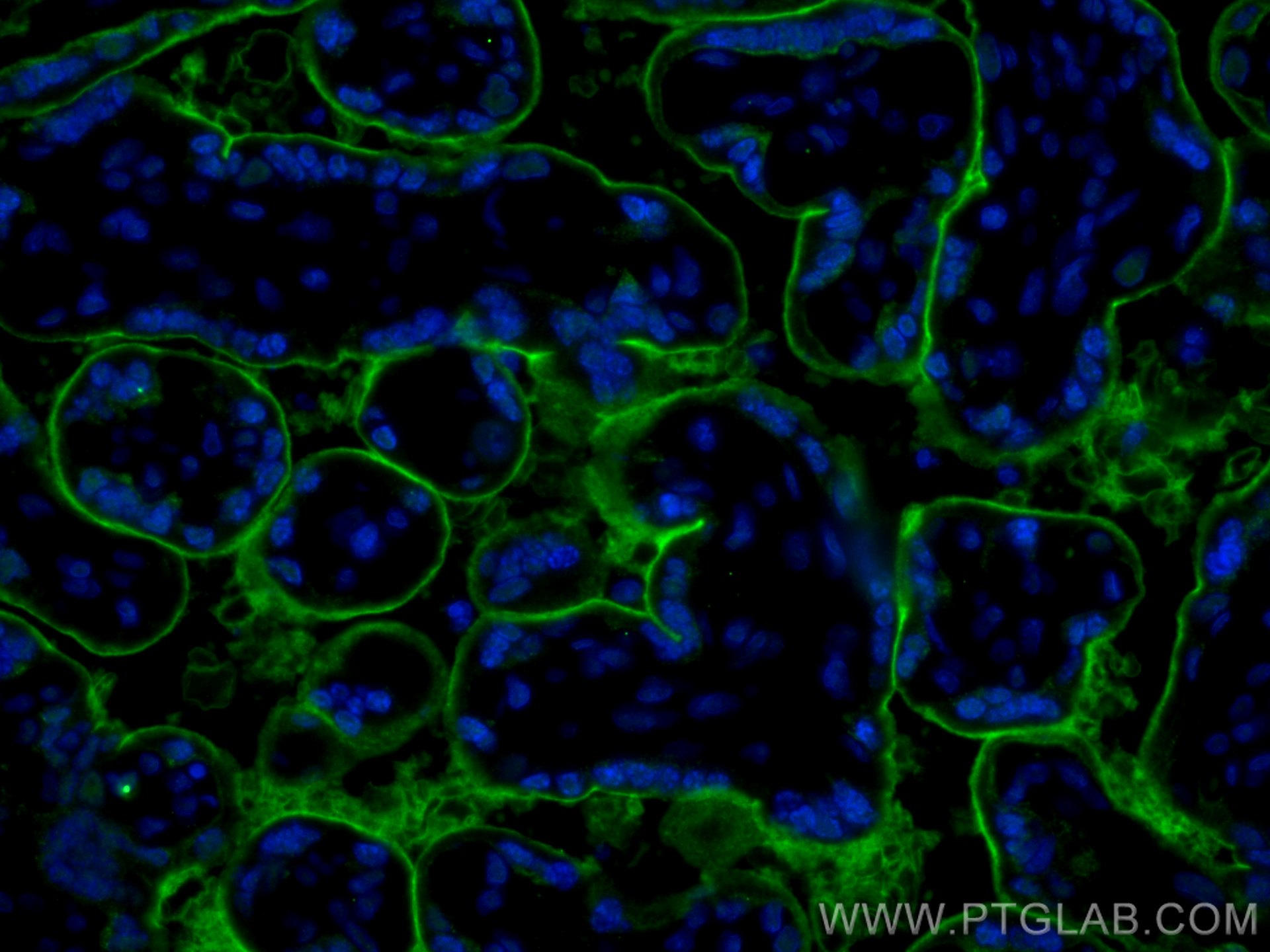 Immunofluorescence (IF) / fluorescent staining of human placenta tissue using CD39/ENTPD1 Polyclonal antibody (19229-1-AP)