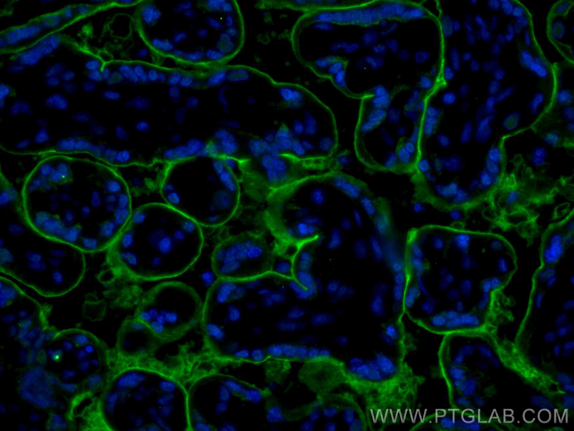 IF Staining of human placenta using 19229-1-AP