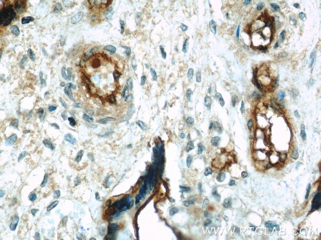 Immunohistochemistry (IHC) staining of human placenta tissue using CD39/ENTPD1 Polyclonal antibody (19229-1-AP)