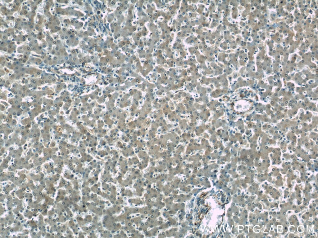 Immunohistochemistry (IHC) staining of human liver tissue using CD39/ENTPD1 Polyclonal antibody (19229-1-AP)