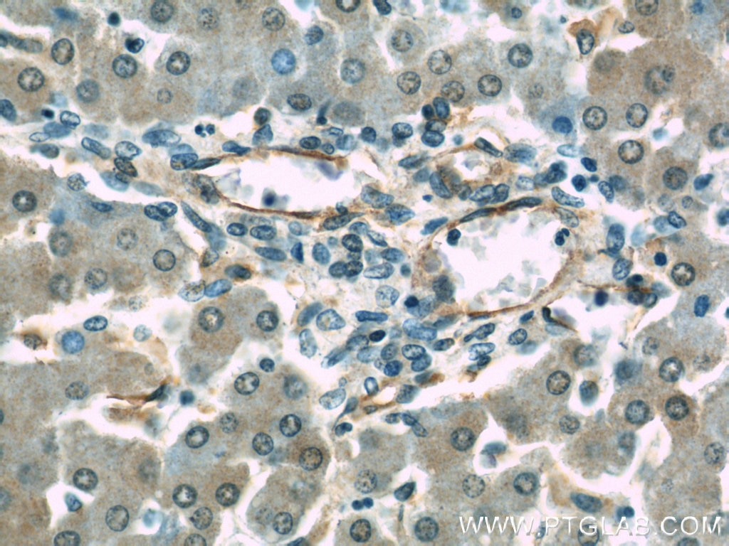 Immunohistochemistry (IHC) staining of human liver tissue using CD39/ENTPD1 Polyclonal antibody (19229-1-AP)