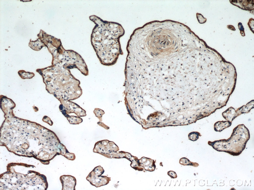 Immunohistochemistry (IHC) staining of human placenta tissue using CD39/ENTPD1 Polyclonal antibody (19229-1-AP)