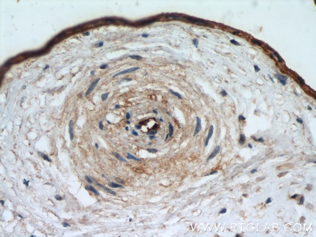 Immunohistochemistry (IHC) staining of human placenta tissue using CD39/ENTPD1 Polyclonal antibody (19229-1-AP)