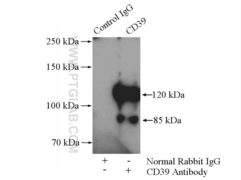 Immunoprecipitation (IP) experiment of mouse liver tissue using CD39/ENTPD1 Polyclonal antibody (19229-1-AP)