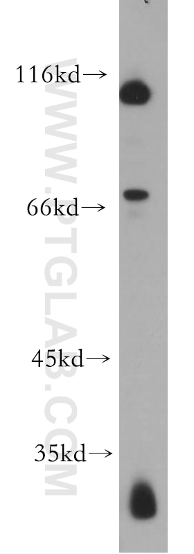 Western Blot (WB) analysis of HL-60 cells using CD39/ENTPD1 Polyclonal antibody (19229-1-AP)