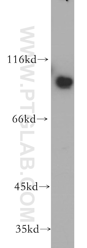 Western Blot (WB) analysis of Jurkat cells using CD39/ENTPD1 Polyclonal antibody (19229-1-AP)